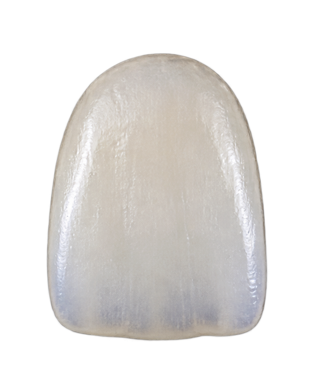 Carilla dental de Disilicato